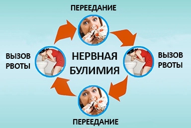 Лечение булимии в Слюдянке